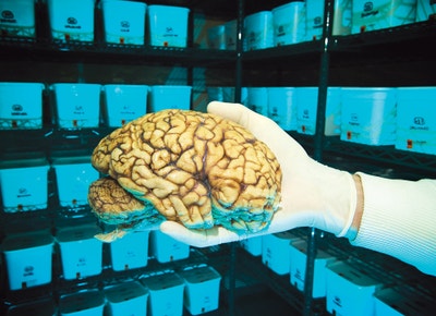 Brain bank-image
