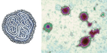image title: Measles virus