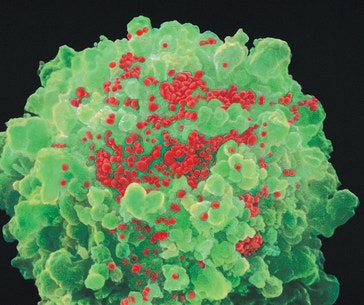 image title: HIV virus