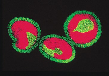 image title: Influenza viruses