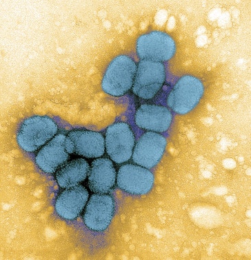 image title: Smallpox viruses